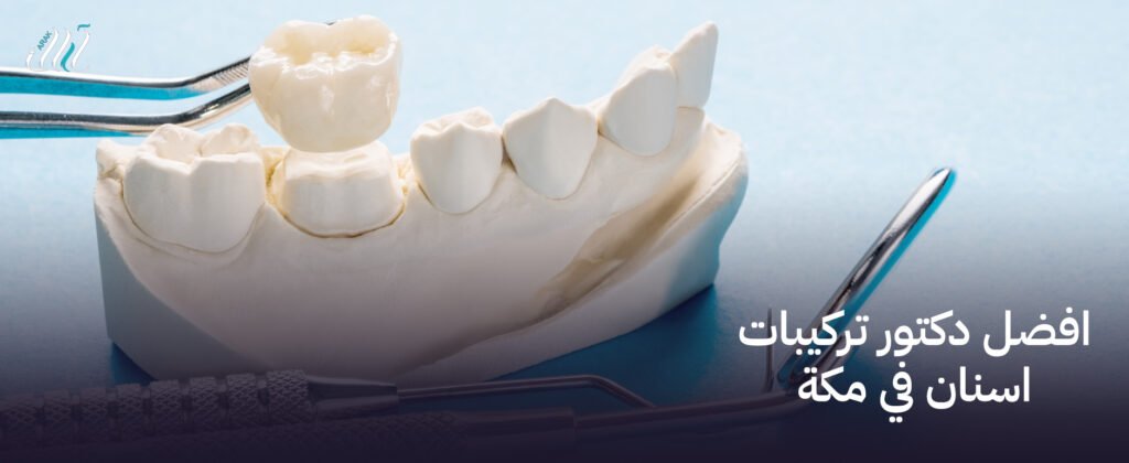 افضل دكتور تركيبات اسنان في مكة – استعد لابتسامة مثالية!