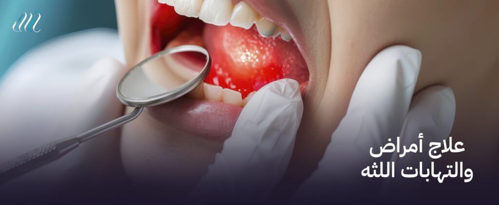 علاج أمراض والتهابات اللثه دليلك الشامل لصحة فم متكاملة