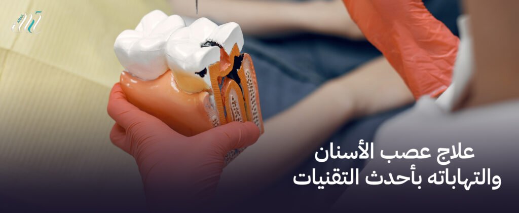 علاج عصب الأسنان والتهاباته بأحدث التقنيات