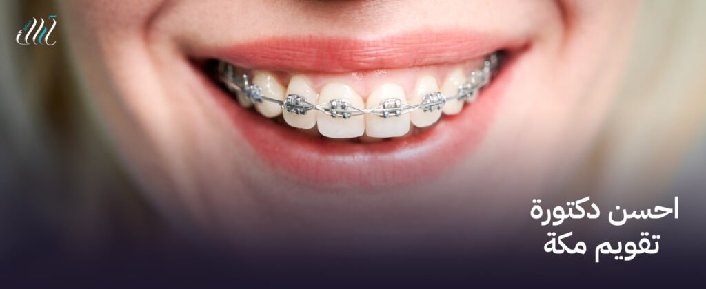 احسن دكتورة تقويم مكة ,ابتسامة مثالية تبدأ هنا ,احجز الان!
