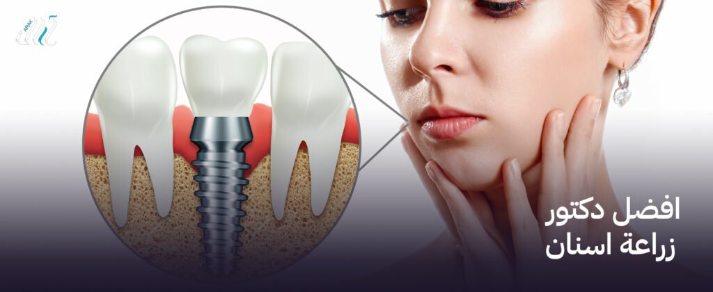 افضل دكتور زراعة اسنان  – خدمات زراعة أسنان بأعلى مستوى