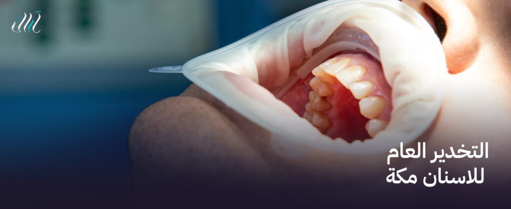 التخدير العام للاسنان مكة  – خدمات متميزة بأعلى درجات الأمان