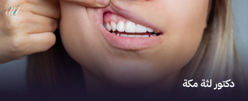 أفضل دكتور لثة مكة  – احصل على علاج فعال لأسنانك!