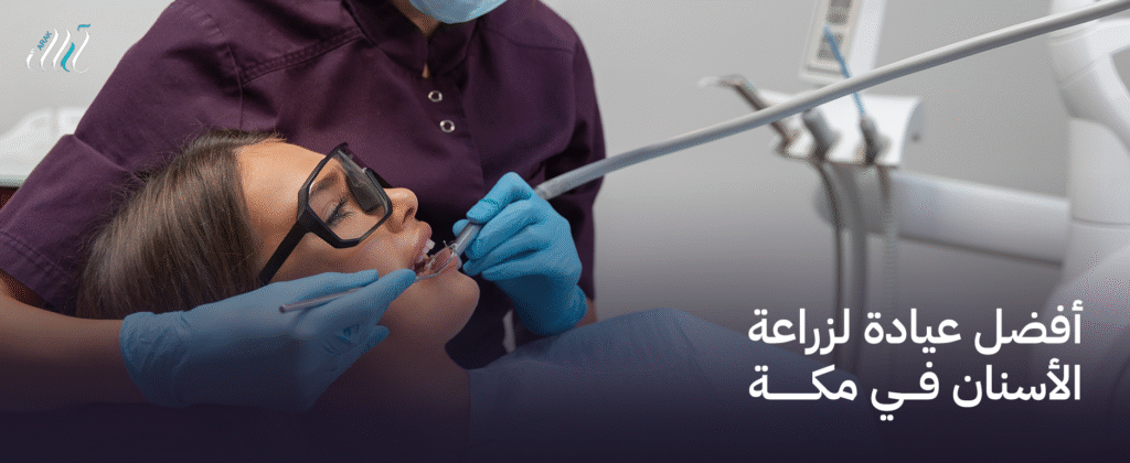 أفضل عيادة لزراعة الأسنان في مكة | خبرة وجودة مضمونة