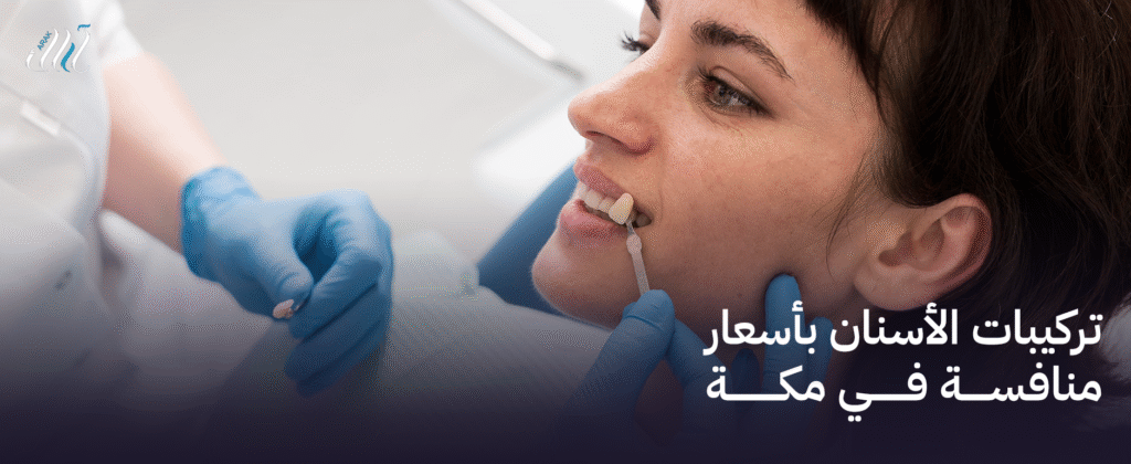 تركيبات الأسنان بأسعار منافسة في مكة | ابتسامة جديدة بتكلفة مناسبة