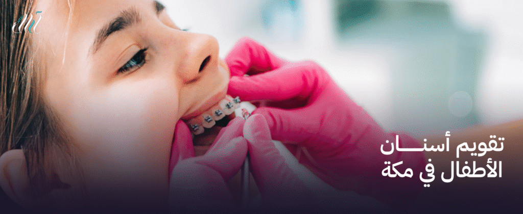 تقويم أسنان الأطفال في مكة  | ابتسامة صحية لأطفالك