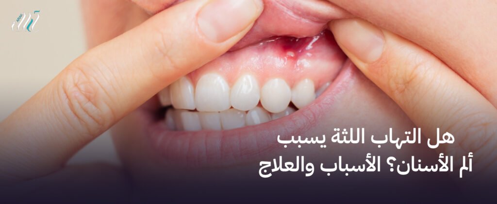 هل التهاب اللثة يسبب ألم الأسنان؟ الأسباب والعلاج الفعّال
