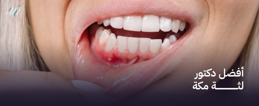 أفضل دكتور لثة مكة , احصل على ابتسامة صحية اليوم!