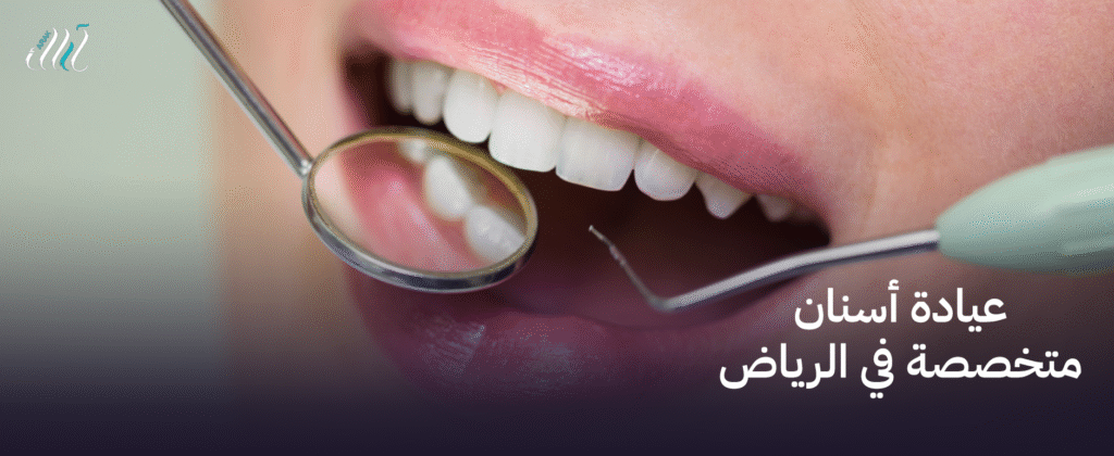عيادة أسنان متخصصة في الرياض – خدمات احترافية لأفضل ابتسامة