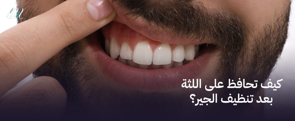 كيف تحافظ على اللثة بعد تنظيف الجير؟