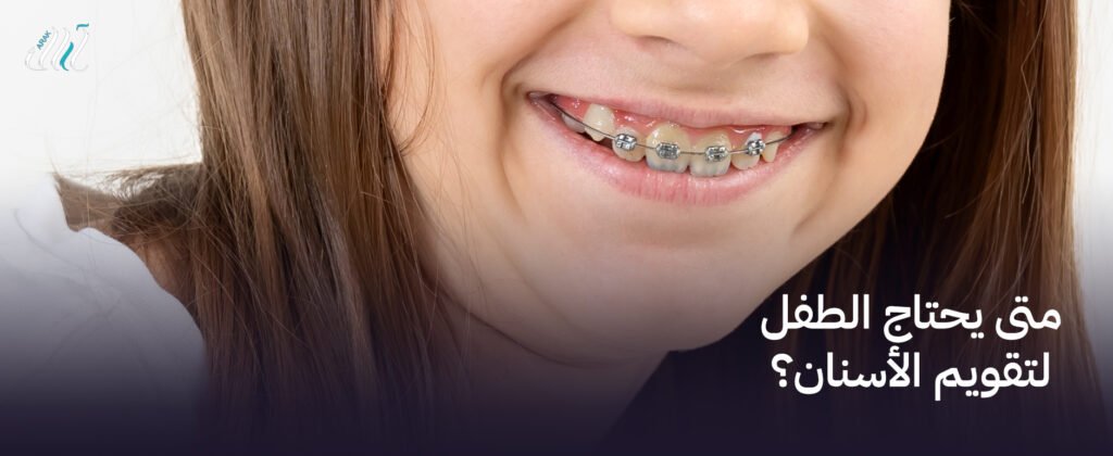 متى يحتاج الطفل لتقويم الأسنان؟ | احصل على استشارة مجانية الآن