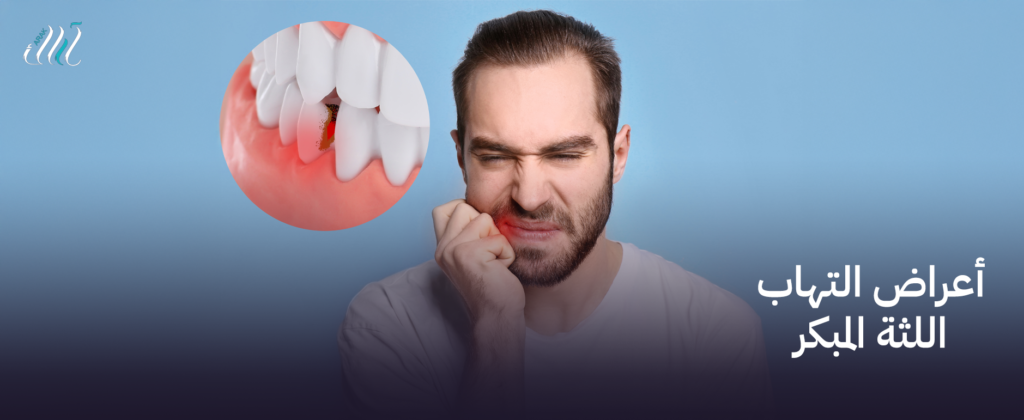 أعراض التهاب اللثة المبكر | احمِ أسنانك قبل تفاقم المشكلة