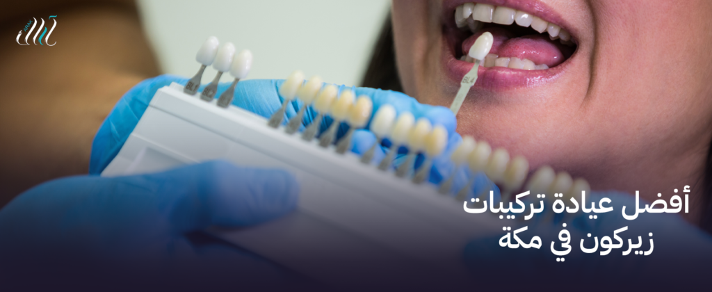أفضل عيادة تركيبات زيركون في مكة – ابتسامة جميلة ومثالية