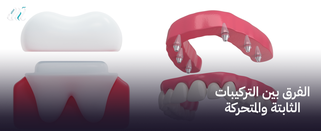 الفرق بين التركيبات الثابتة والمتحركة – اختر الأنسب لك من بين الخيارات