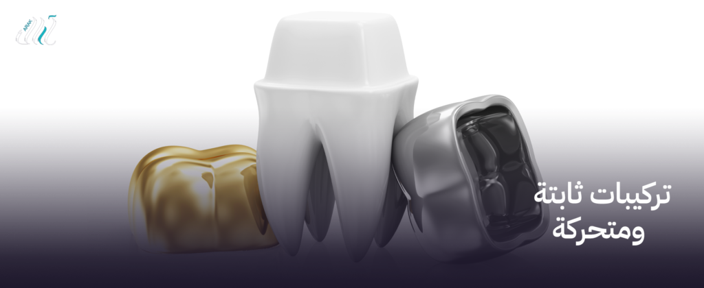 تركيبات ثابتة ومتحركة | ابتسامة طبيعية تدوم مع أفضل النتائج