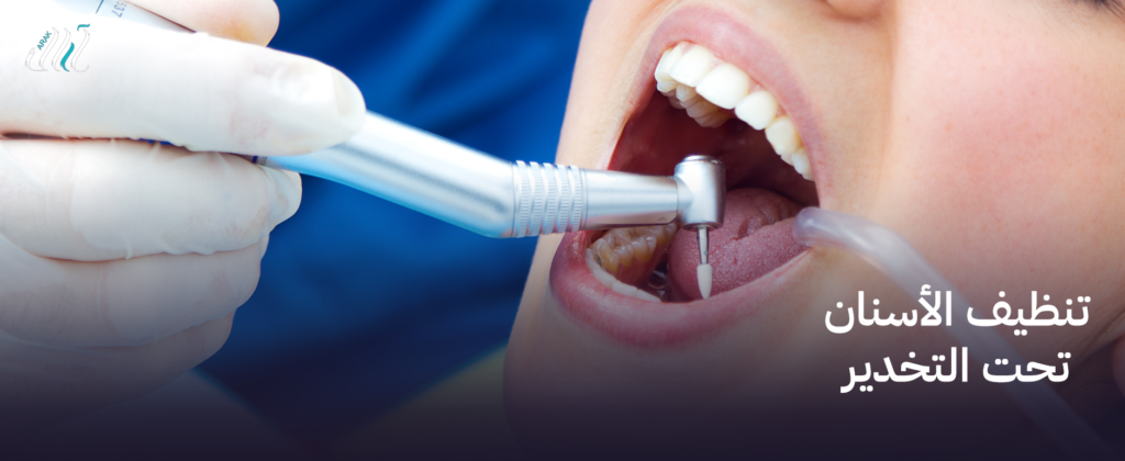 تنظيف الأسنان تحت التخدير | راحة كاملة بدون ألم