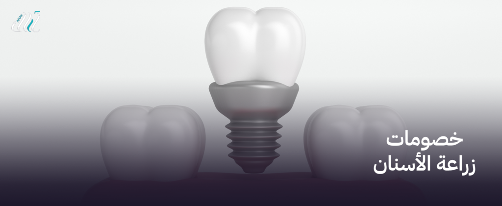خصومات زراعة الأسنان رائعة في جدة – احصل على ابتسامة جديدة الآن
