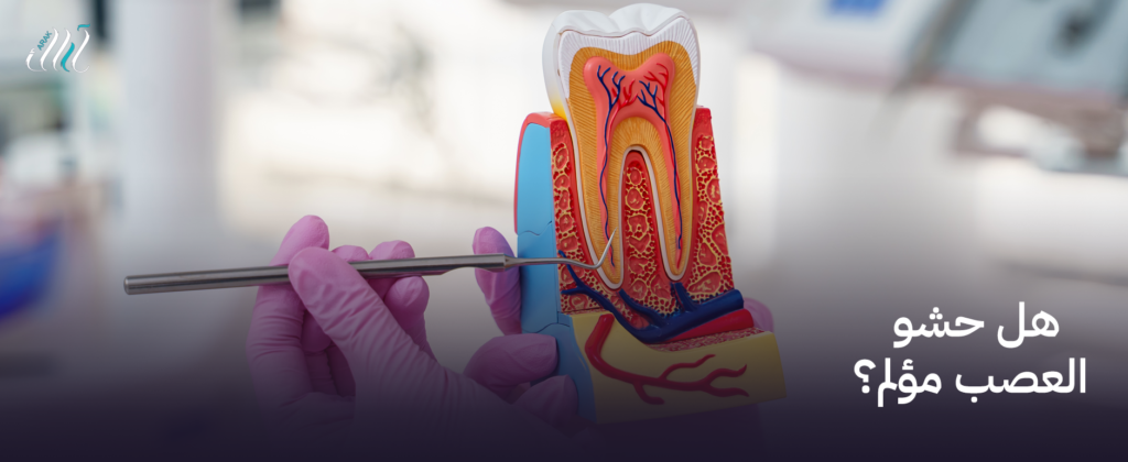 هل حشو العصب مؤلم؟ اكتشف الحقيقة واحجز موعدك اليوم