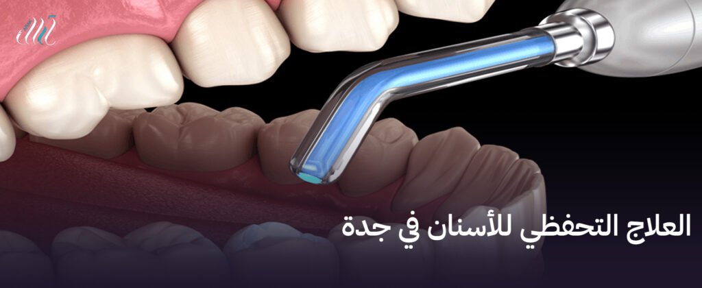 العلاج التحفظي للأسنان في جدة, حماية أسنانك دون الحاجة للتدخل الجراحي