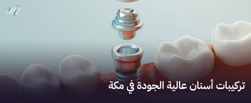 تركيبات أسنان عالية الجودة في مكة, ابتسامة ساحرة تبدأ من هنا