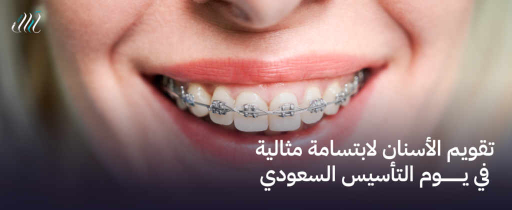 تقويم الأسنان لابتسامة مثالية في يوم التأسيس السعودي | ابتسامة رائعة