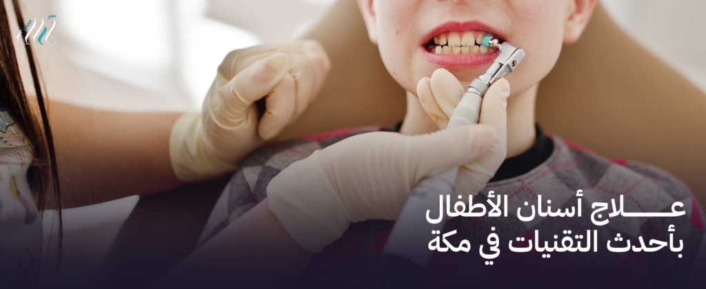 علاج أسنان الأطفال بأحدث التقنيات في مكة – احجز الآن لأفضل رعاية