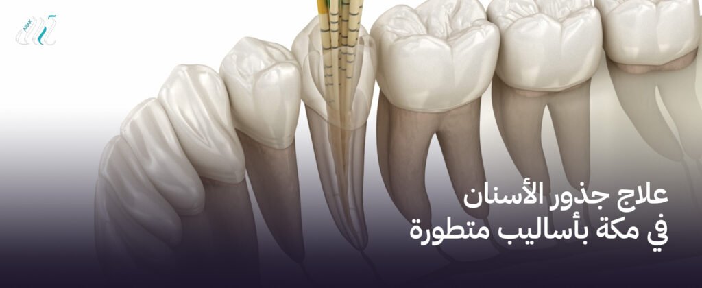 علاج جذور الأسنان في مكة بأساليب متطورة ,استعادة صحتك بأسلوب مبتكر