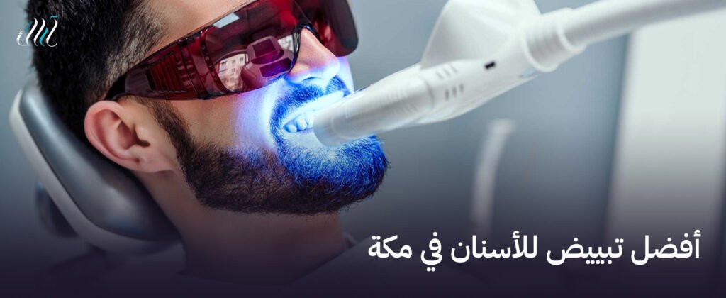 أفضل تبييض للأسنان في مكة  - ابتسامة لامعة وجذابة