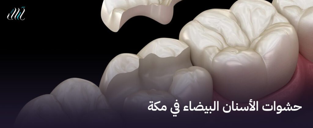 حشوات الأسنان البيضاء في مكة – احصل على ابتسامة ناصعة الآن!